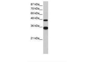 Image no. 1 for anti-General Transcription Factor IIH, Polypeptide 4, 52kDa (GTF2H4) (N-Term) antibody (ABIN202577) (GTF2H4 anticorps  (N-Term))