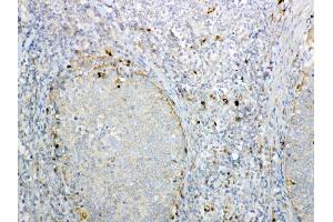 IHC analysis of GALNS using anti-GALNS antibody .