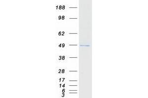 Validation with Western Blot