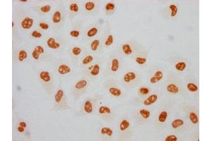 Immunocytochemistry analysis of ABIN7127726 diluted at 1:75 and staining in Hela cells(treated with 100 ng/mL EGF for 4h) performed on a Leica BondTM system.