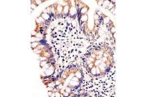 Immunohistochemical analysis of paraffin-embedded H.