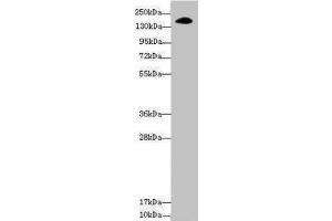 Western blot All lanes: NUP155 antibody at 3. (NUP155 anticorps  (AA 1102-1391))