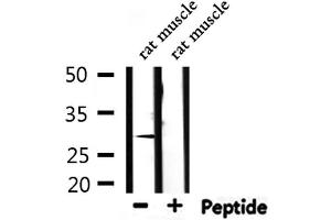 Western blot analysis of extracts from rat muscle, using DCN Antibody. (Decorin anticorps  (Internal Region))