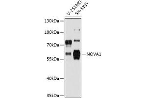 Western blot analysis of extracts of various cell lines, using NOV antibody (2030) at 1:3000 dilution. (NOVA1 anticorps  (AA 408-507))