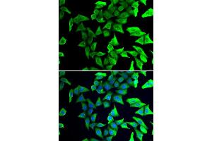 Immunofluorescence analysis of U20S cell using VSNL1 antibody. (VSNL1 anticorps)