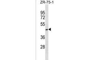 ST6GALNAC5 Antibody (C-term) (ABIN1881843 and ABIN2838433) western blot analysis in ZR-75-1 cell line lysates (35 μg/lane). (ST6GALNAC5 anticorps  (C-Term))