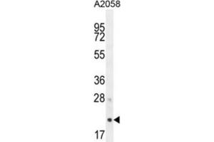 Western Blotting (WB) image for anti-Adaptor-Related Protein Complex 3, sigma 1 Subunit (AP3S1) antibody (ABIN2995675) (AP3S1 anticorps)