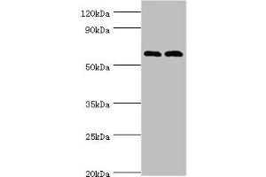 Western blot All lanes: Serine/threonine-protein kinase PAK 2 antibody at 2 μg/mL Lane 1: Jurkat whole cell lysate Lane 2: Hela whole cell lysate Secondary Goat polyclonal to rabbit IgG at 1/10000 dilution Predicted band size: 58 kDa Observed band size: 58 kDa (PAK2 anticorps  (AA 1-212))