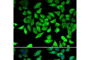 Immunofluorescence analysis of U2OS cells using CCAR2 Polyclonal Antibody (CCAR2 anticorps)