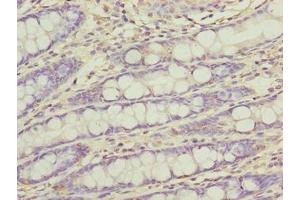 Immunohistochemistry of paraffin-embedded human colon tissue using ABIN7165470 at dilution of 1:100 (FAM222B anticorps  (AA 351-562))