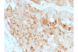Formalin-fixed, paraffin-embedded human Kidney stained with ROR2 Mouse Monoclonal Antibody (ROR2/1911).