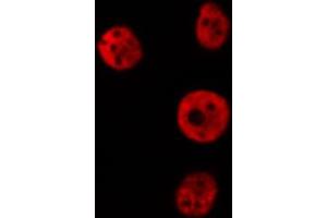 ABIN6274172 staining Hela cells by IF/ICC. (IRF2 anticorps  (Internal Region))