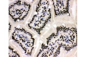 IHC analysis of XRCC1 using anti-XRCC1 antibody (ABIN5693138).