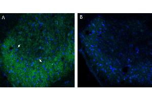 anti-Bestrophin 1 (BEST1) (3rd Extracellular Loop), (AA 259-270) antibody