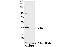Western Blotting (WB) image for anti-Membrane-Spanning 4-Domains, Subfamily A, Member 1 (MS4A1) antibody (ABIN7449560) (CD20 anticorps)