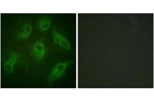 Immunofluorescence analysis of HeLa cells, using MAP4 (Ab-696) Antibody. (MAP4 anticorps  (AA 662-711))