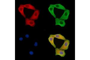 ABIN7095803 and ABIN7099865 staining Hela cells by IF/ICC. (CARS2 anticorps)