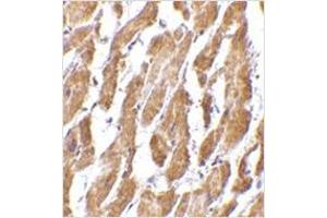 Immunohistochemistry of CRTH2 in human heart tissue with CRTH2 antibody at 2. (Prostaglandin D2 Receptor 2 (PTGDR2) (N-Term) anticorps)