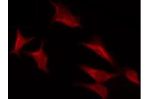 ABIN6267438 staining NIH-3T3 by IF/ICC.