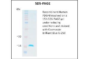 SDS-PAGE (SDS) image for Platelet Derived Growth Factor Subunit B (PDGFB) (Active) protein (ABIN5509325) (PDGFB Protéine)