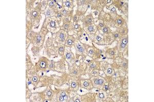 Immunohistochemistry of paraffin-embedded human liver injury using HIP1 antibody at dilution of 1:100 (x40 lens). (HIP1 anticorps)