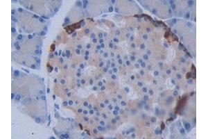 DAB staining on IHC-P; Samples: Rat Pancreas Tissue (METTL21C anticorps  (AA 1-248))