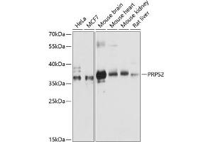 Western blot analysis of extracts of various cell lines, using PRPS2 antibody (ABIN6132521, ABIN6146272, ABIN6146274 and ABIN6216352) at 1:3000 dilution. (PRPS2 anticorps  (AA 1-240))