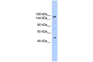 SHPRH antibody used at 1 ug/ml to detect target protein.