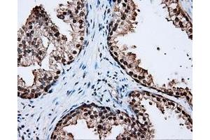 Immunohistochemical staining of paraffin-embedded liver tissue using anti-LTA4H mouse monoclonal antibody. (LTA4H anticorps)