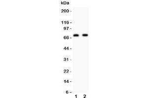 Western blot testing of Numb antibody and Lane 1: human U87;  2: mouse Neuro-2a lysate. (NUMB anticorps  (AA 194-220))