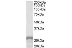 Western Blotting (WB) image for anti-Paired-Like Homeobox 2a (PHOX2A) (AA 165-179), (Internal Region) antibody (ABIN1108647) (PHOX2A anticorps  (Internal Region))