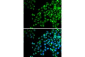 Immunofluorescence analysis of HeLa cell using EPC1 antibody. (EPC1 anticorps)