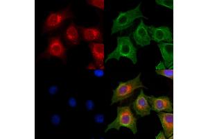 ABIN7094414 and ABIN7098461 staining HepG2 cells by IF/ICC. (OGDHL anticorps  (Internal Region))