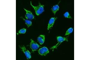 IF analysis of TFEB using anti-TFEB antibody (ABIN7600648).