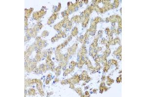 Immunohistochemistry of paraffin-embedded human liver using MOK antibody (ABIN3022550, ABIN3022551, ABIN3022552 and ABIN6218895) at dilution of 1:100 (40x lens).