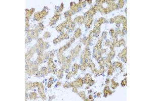 Immunohistochemistry of paraffin-embedded human liver using MOK antibody (ABIN3022550, ABIN3022551, ABIN3022552 and ABIN6218895) at dilution of 1:100 (40x lens). (MOK anticorps  (AA 1-230))