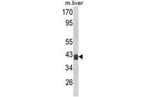 Western blot analysis of TOB1 Antibody (N-term) Cat. (Protein Tob1 (TOB1) (AA 61-91), (N-Term) anticorps)