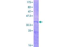 Image no. 1 for Agouti Signaling Protein (ASIP) (AA 33-132) protein (GST tag) (ABIN1345856)