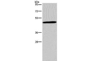 Western Blot analysis of 293T cell using Glucagon Receptor Polyclonal Antibody at dilution of 1:200 (Glucagon Receptor anticorps)