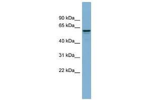 Dynactin 4 antibody used at 1 ug/ml to detect target protein. (Dynactin 4 anticorps)