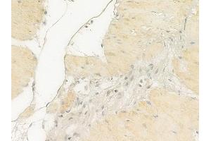 ABIN6256870 and ABIN6274846 at 1/100 staining human normal gastric tissue by IHC-P. (Calcium Responsive Transcription Factor (CARF) (Internal Region) anticorps)