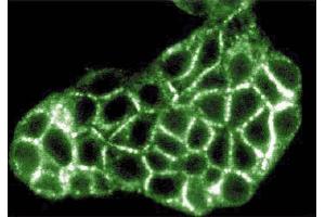 Immunofluorescence staining of MDCK cells (canine kidney, ATCC CCL-34). (ITPR3 anticorps  (AA 22-230))