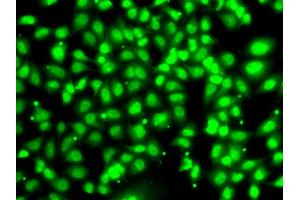 Immunofluorescence analysis of U2OS cells using COPS2 antibody (ABIN5974233). (COPS2 anticorps)