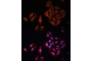 Immunofluorescence analysis of U-2 OS cells using B Polyclonal Antibody (ABIN6131247, ABIN6137447, ABIN6137448 and ABIN6222194) at dilution of 1:100 (40x lens). (BAP1 anticorps  (AA 460-729))