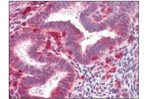 Immunohistochemistry (IHC) image for anti-Fibroblast Growth Factor Receptor 4 (FGFR4) antibody (ABIN356413)