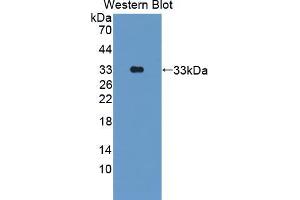 Western blot analysis of the recombinant protein. (PKN2 anticorps  (AA 67-312))