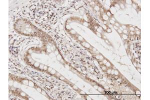 Immunoperoxidase of monoclonal antibody to FAM50A on formalin-fixed paraffin-embedded human small Intestine. (FAM50A anticorps  (AA 1-88))