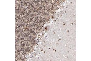 Immunohistochemical staining of human cerebellum with MLLT3 polyclonal antibody  shows strong nuclear positivity in purkinje cells at 1:50-1:200 dilution.
