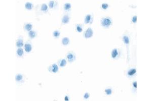 Stained with an isotype control