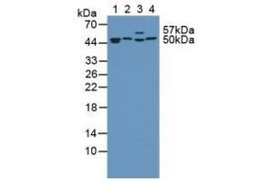 Detection of PSMC4 in Human Kidney Tissue using Polyclonal Antibody to Proteasome 26S Subunit, ATPase 4 (PSMC4)
